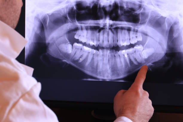 Best Dental Abscess Treatment in Channelview, TX